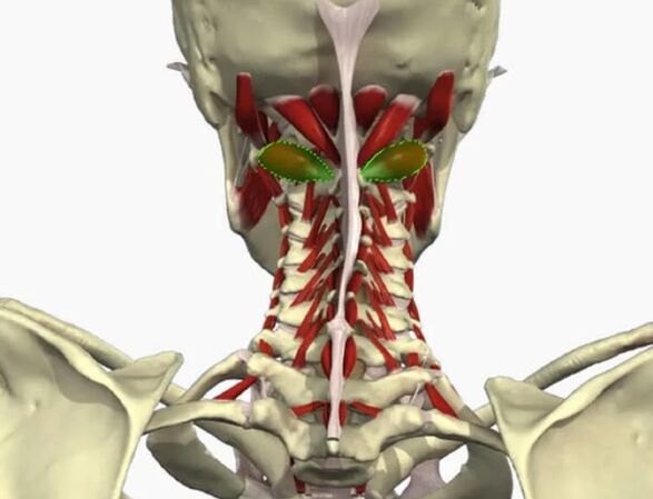 Vertebral artery syndrome